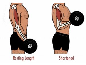 מנח שריר ארוך