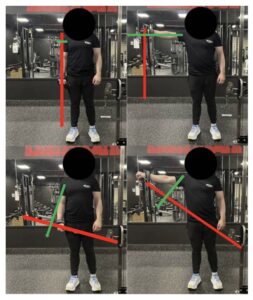 עבודה במנח שריר ארוך